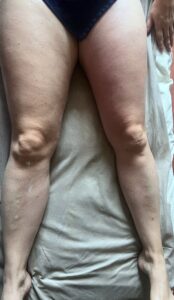 drainage renata soin corps