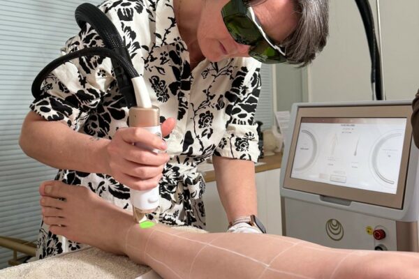 LASER SANDRINE LASER SANDRINE