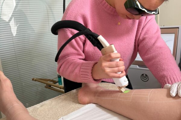 laser angele laser angele